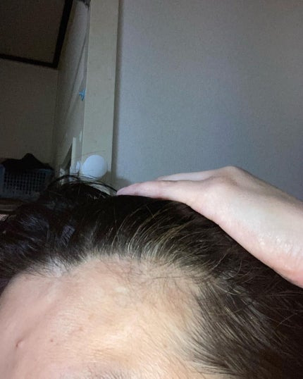 にゃんこ on LIPS 「awairoアワイロ ムースヘアカラー ダークブラウン試してみ..」(5枚目)