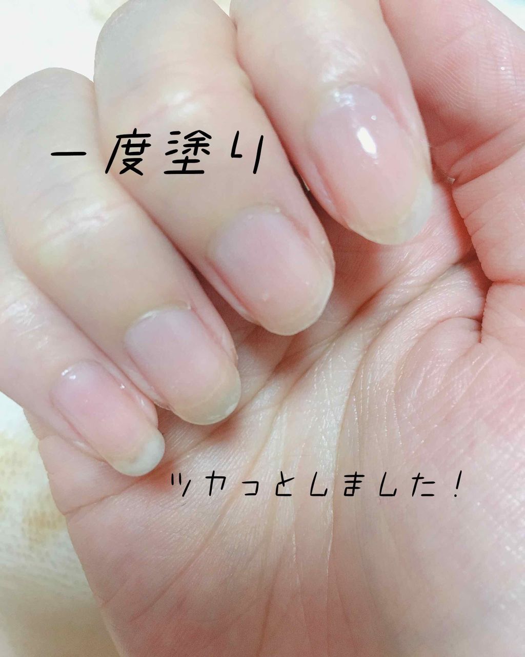 ネイルサポート ピンク/ネイルネイル/ネイルベースコートを使ったクチコミ(3枚目)