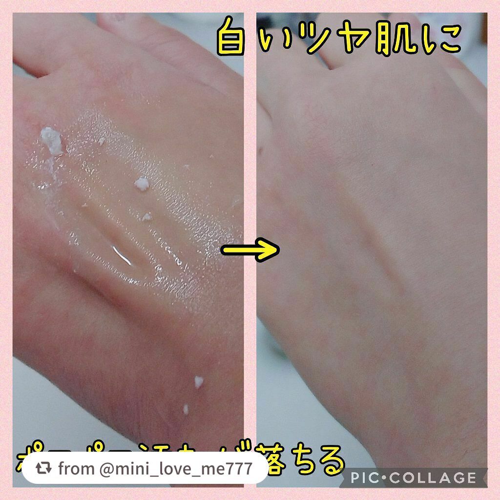 ホワイトクリアジェル/Cure/ピーリングを使ったクチコミ(1枚目)