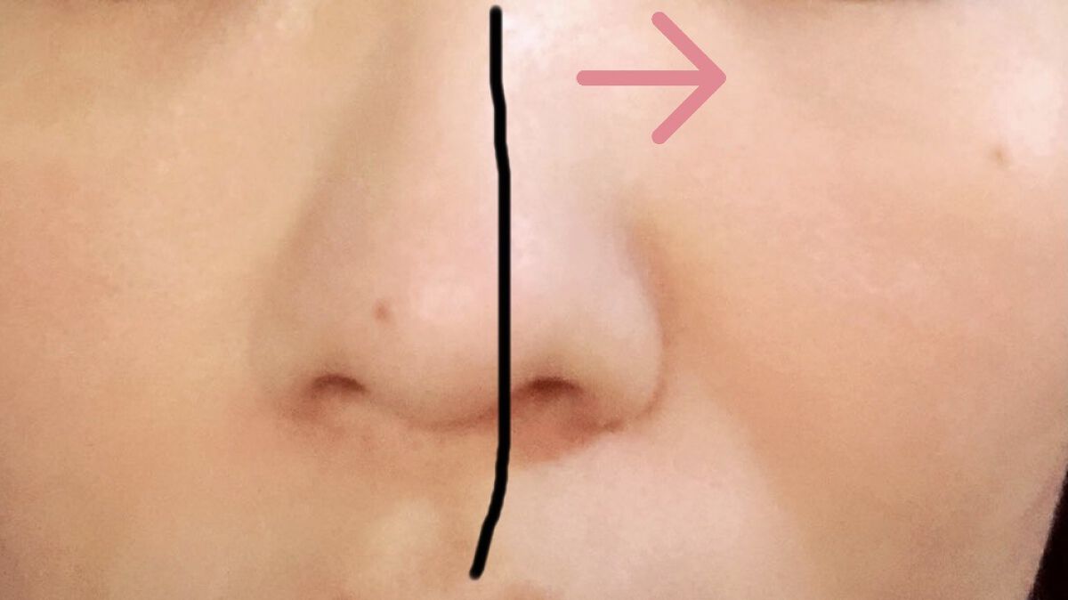 リシェ レッドトリック アイコンシーラー/Visée/パレットコンシーラーを使ったクチコミ（2枚目）