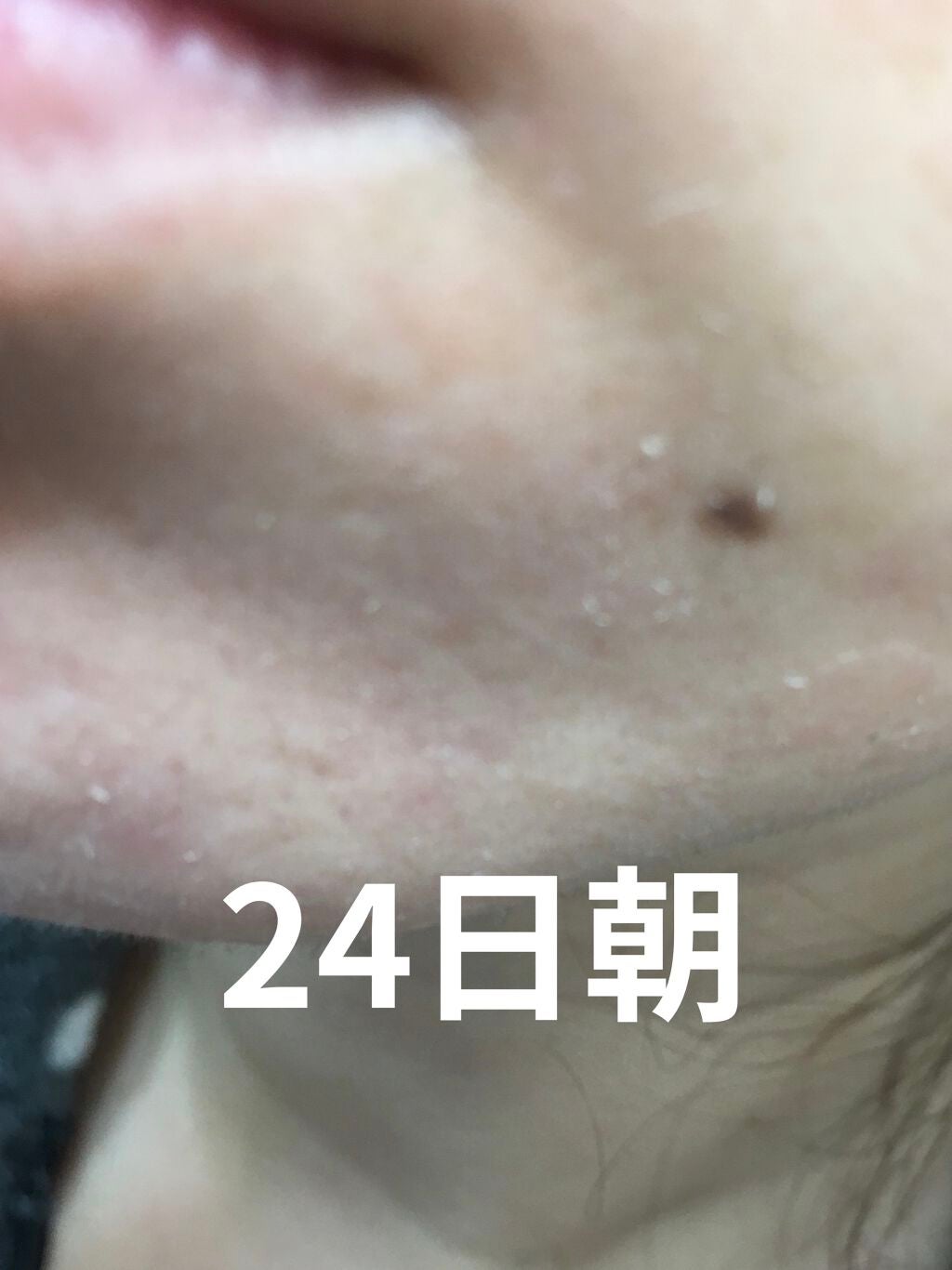 レチノールA 1% アドバンスドリバイタリゼーションクリーム/Life-flo/フェイスクリームを使ったクチコミ(5枚目)