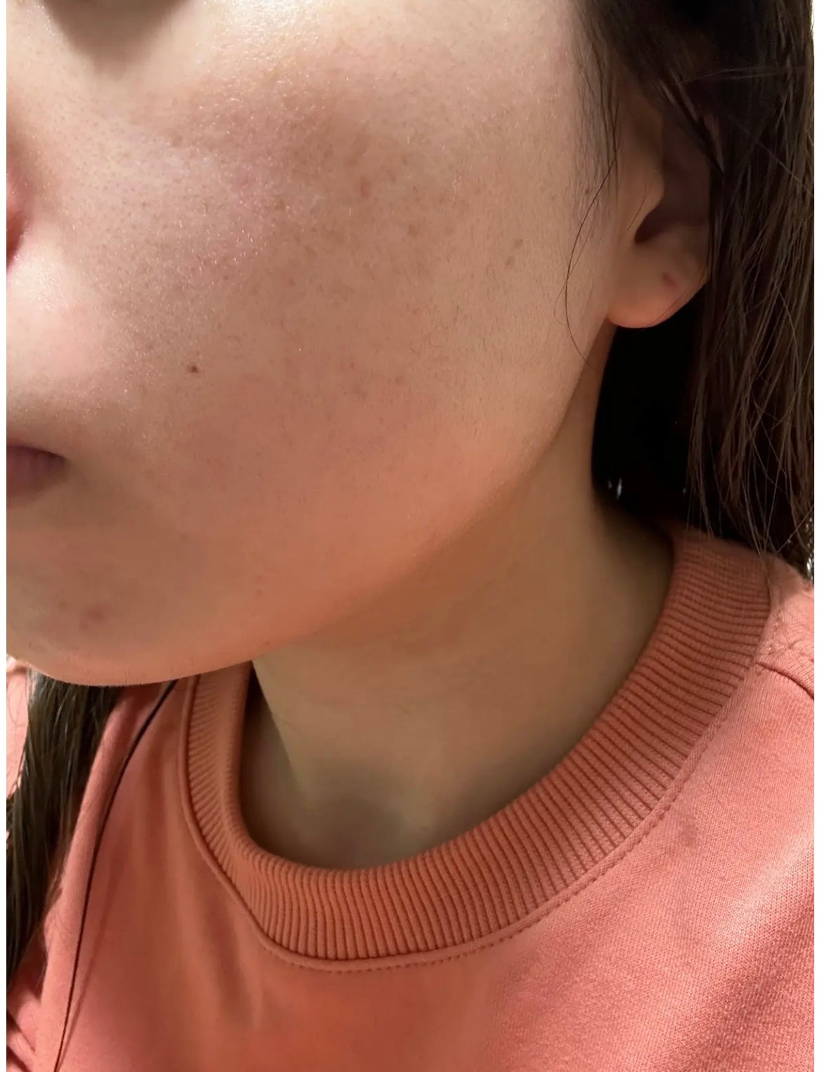 W.H.P ブラックマスク JEX/MEDIHEAL/シートマスク・パックを使ったクチコミ(3枚目)