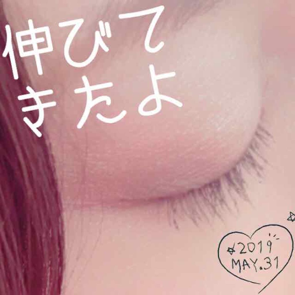 バンビウィンク(旧)/オルト/健康サプリメントを使ったクチコミ（1枚目）