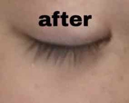 ローヤルゼリー配合 栄養ローション/DAISO/美容液を使ったクチコミ(3枚目)