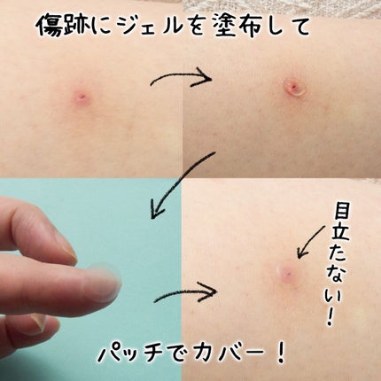 コスザッカ on LIPS 「\ポンポン塗って、貼る!2STEPのレスキューケア👩⚕️/フ..」(5枚目)