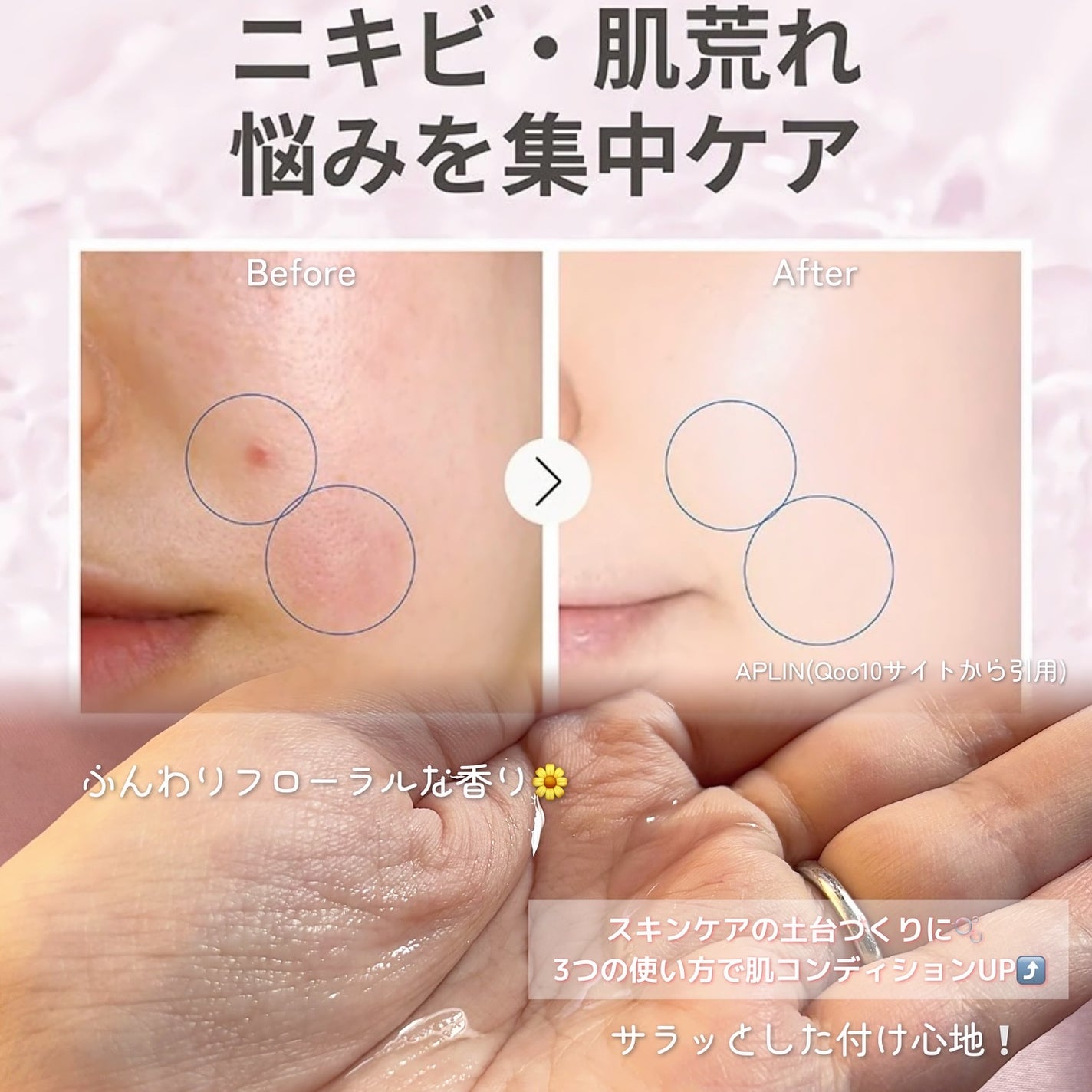 ピンクティーツリートナー/APLIN/化粧水を使ったクチコミ(4枚目)