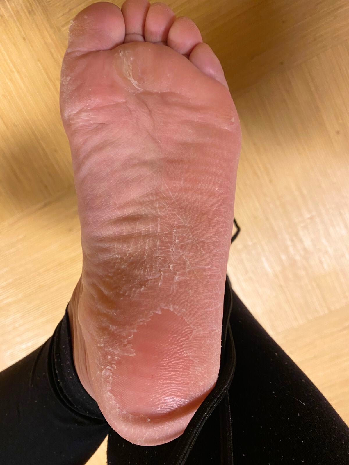 bea's up フットピーリングパック ペロリン グレープフルーツ/素数/レッグ・フットケアを使ったクチコミ(2枚目)