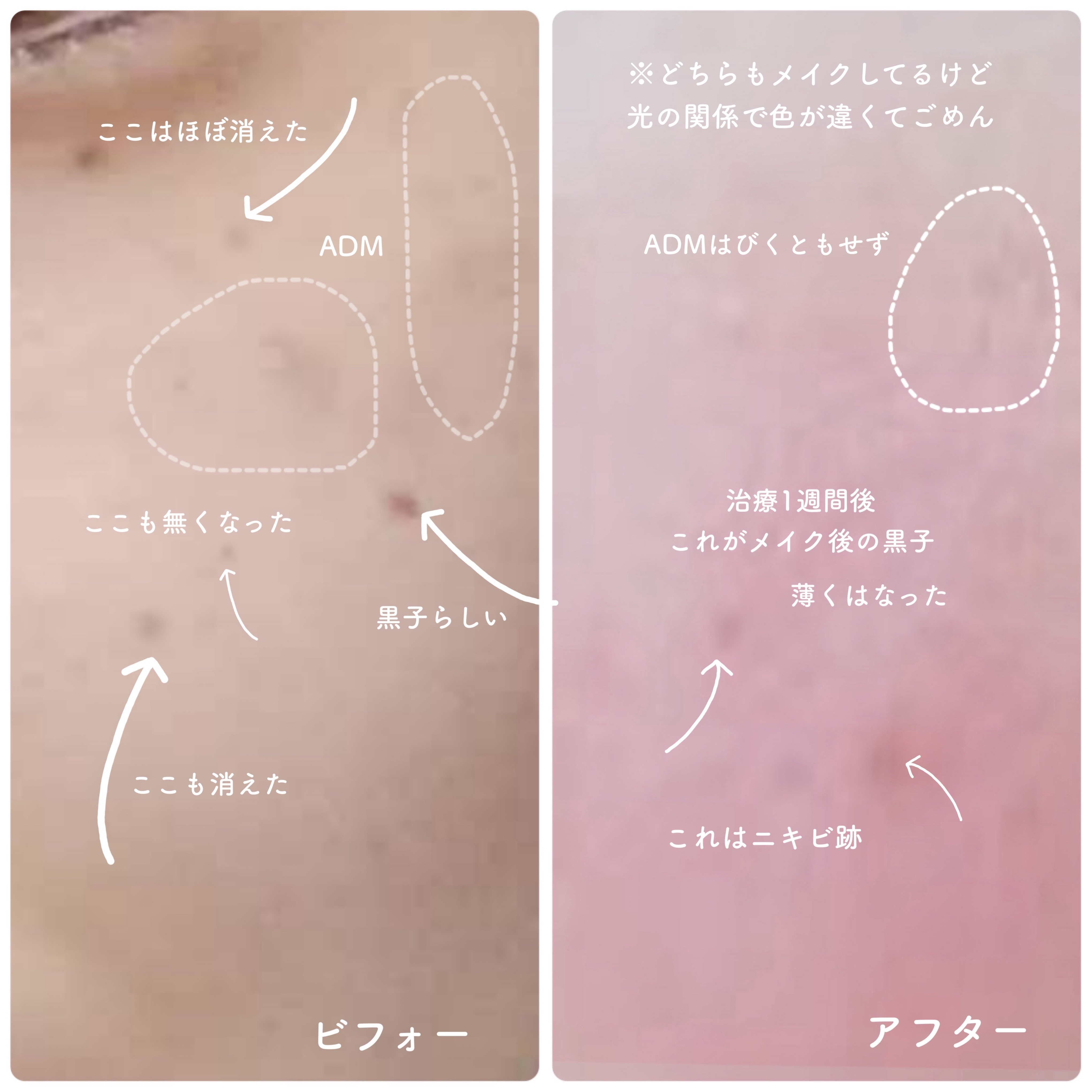 を使ったクチコミ（2枚目）