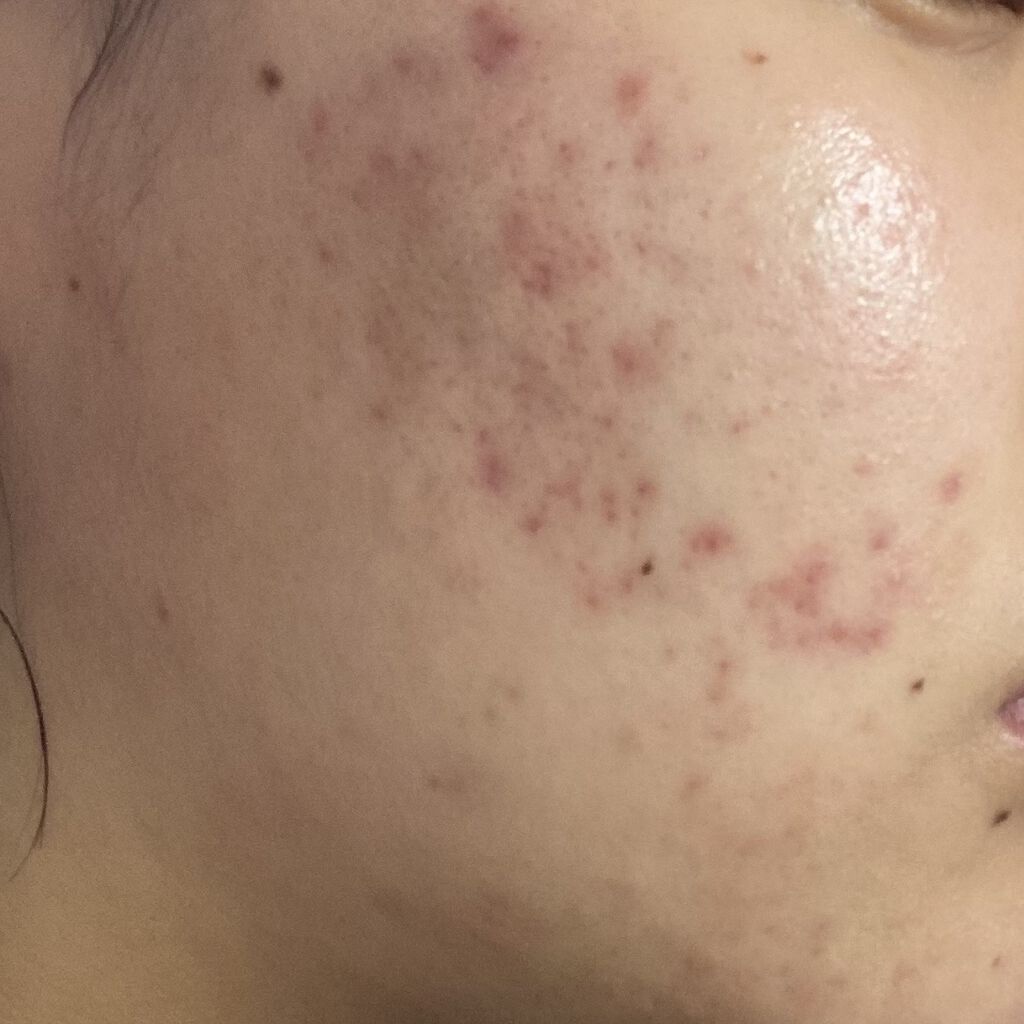 保湿クリーム /ちふれ/フェイスクリームを使ったクチコミ（2枚目）