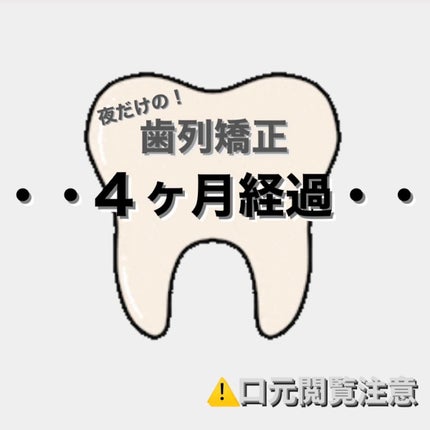 cokko on LIPS 「SH矯正を始めて4ヶ月が経過しました!今回は上 0.8mm下 ..」(1枚目)