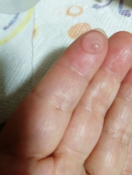 ENRICH SERUM/METLLASSE(メトラッセ)/美容液を使ったクチコミ(4枚目)