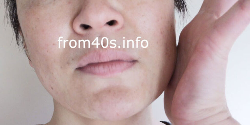 MT ファーストステップ・ローション/MTメタトロン/化粧水を使ったクチコミ（3枚目）