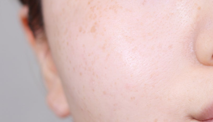 TXトラネキグルタショット/CELLINSHOT/美容液を使ったクチコミ（1枚目）