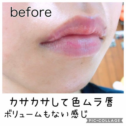 ラシャスリップス/ラシャスリップス/リップグロスを使ったクチコミ(2枚目)