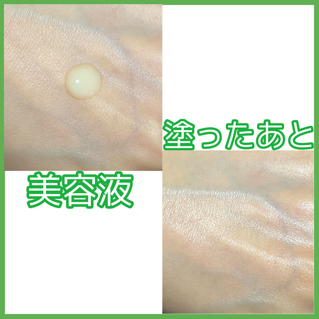 レチノール　シカ　リペア　セラム/innisfree/美容液を使ったクチコミ（3枚目）