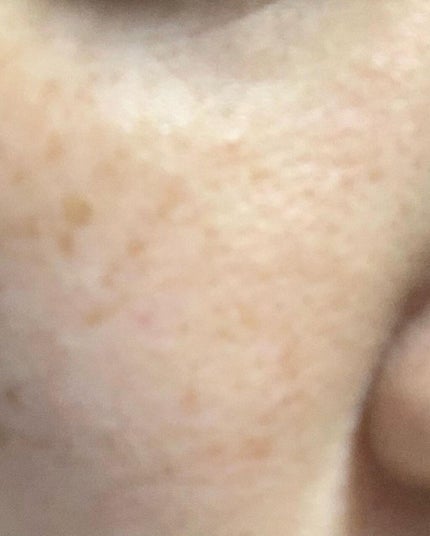 タカミスキンピール/タカミ/ブースター・導入液を使ったクチコミ(4枚目)