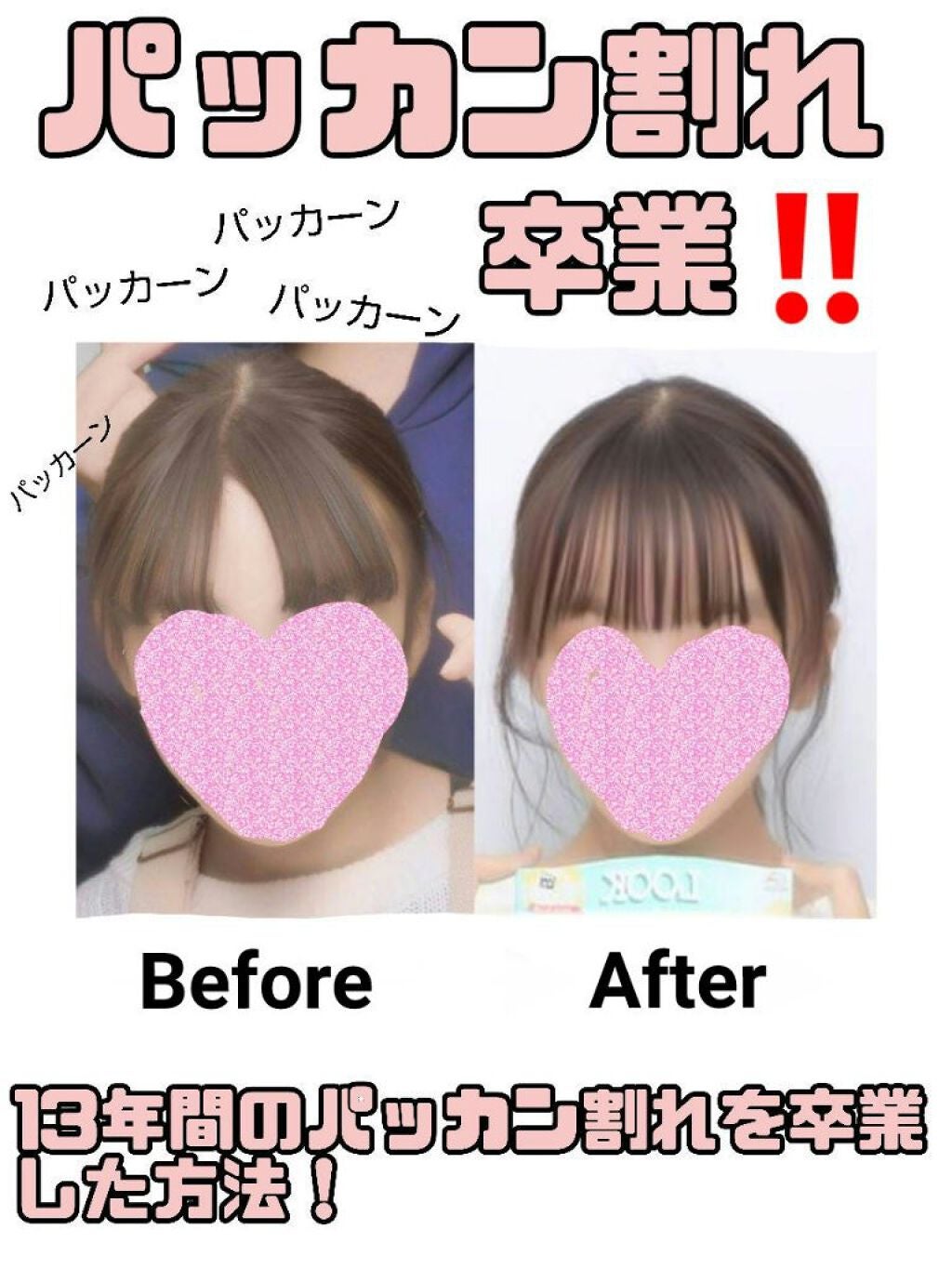 いちごみるく on LIPS 「“13年間パッカン割れ生活を送っていた私が綺麗な前髪を手に入れ..」(1枚目)