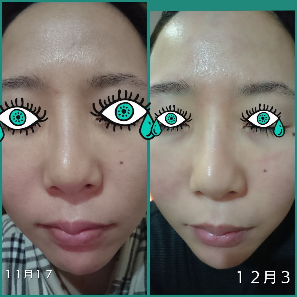 ドクタージャルト シカペア クリーム (第2世代)/Dr.Jart+/フェイスクリームを使ったクチコミ(2枚目)