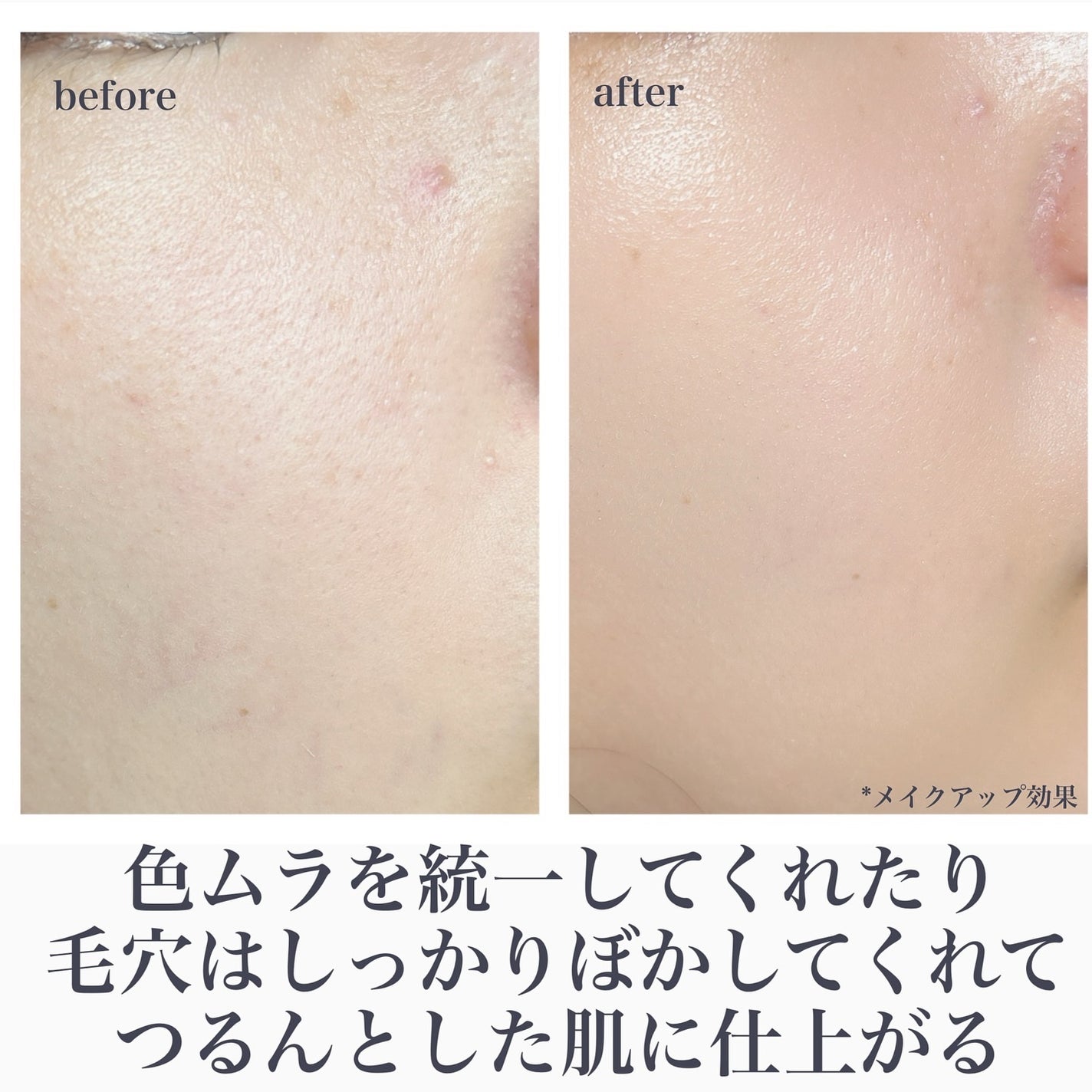 エテュセ フェイスエディション(スキンベース)フォードライスキン/ettusais/化粧下地を使ったクチコミ(5枚目)