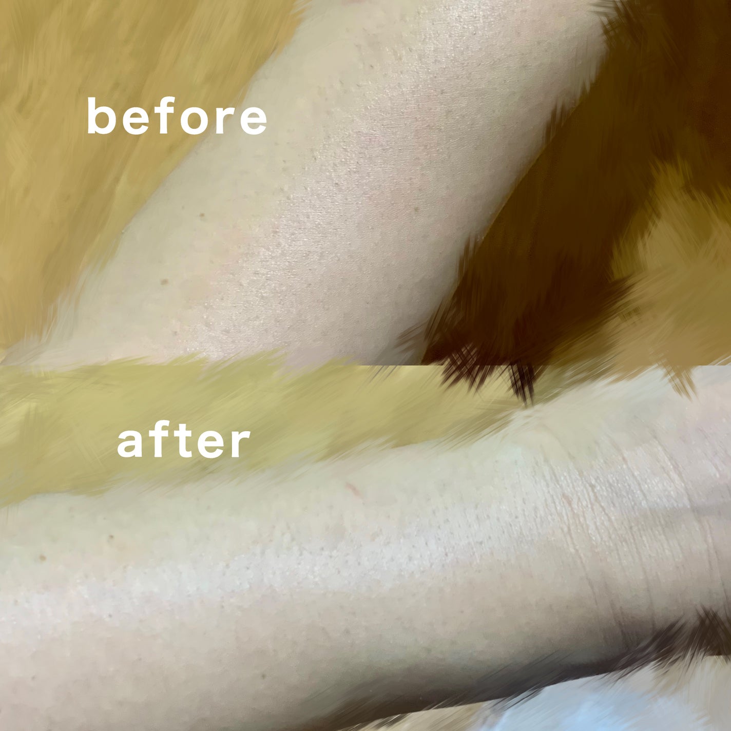 SIPL-1000C 家庭用光美容器/eosika/家庭用脱毛器を使ったクチコミ(4枚目)