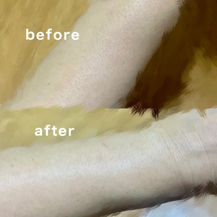 SIPL-1000C 家庭用光美容器/eosika/家庭用脱毛器を使ったクチコミ(4枚目)