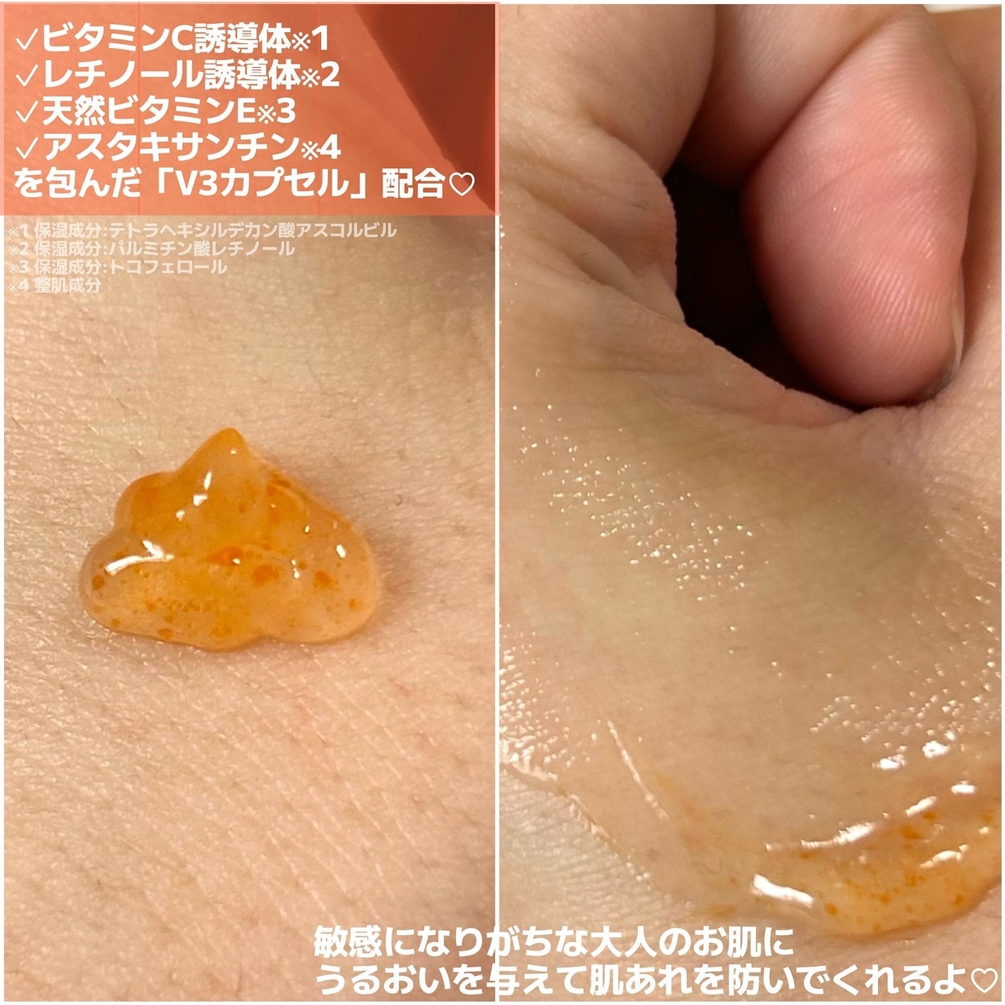 アスタリライズV3エッセンス/アトレージュ AD+/美容液を使ったクチコミ(2枚目)