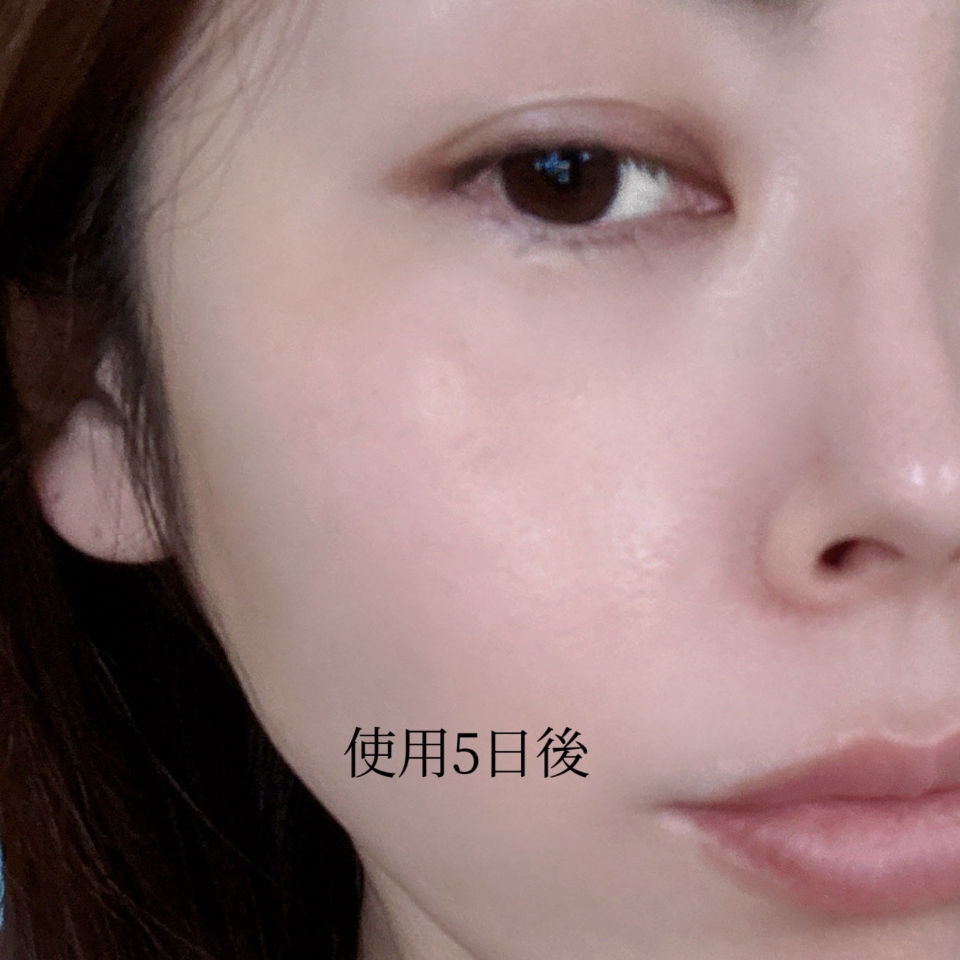 マイルドリードルショット50/VT/美容液を使ったクチコミ(6枚目)