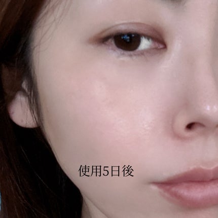 マイルドリードルショット50/VT/美容液を使ったクチコミ(6枚目)