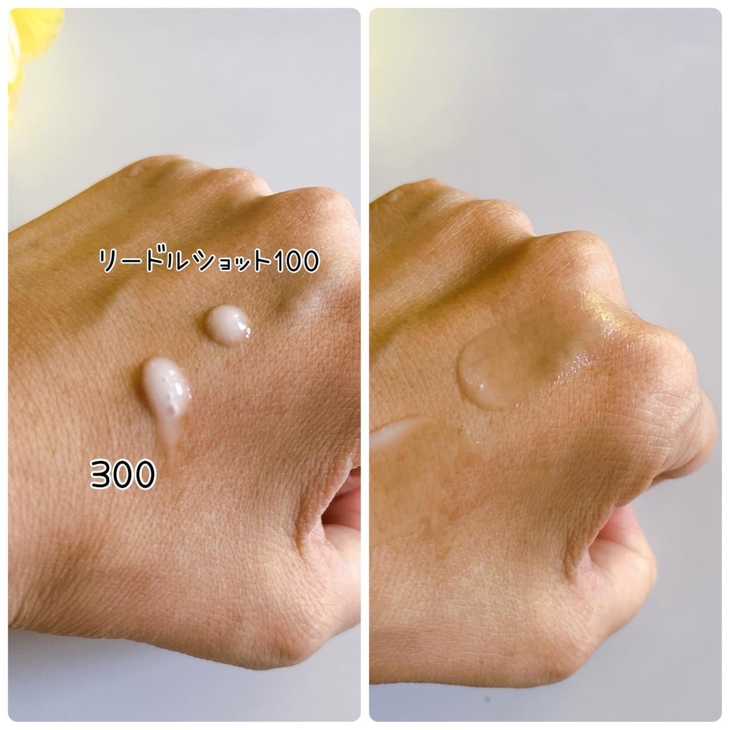 リードルショット100/VT/美容液を使ったクチコミ(2枚目)