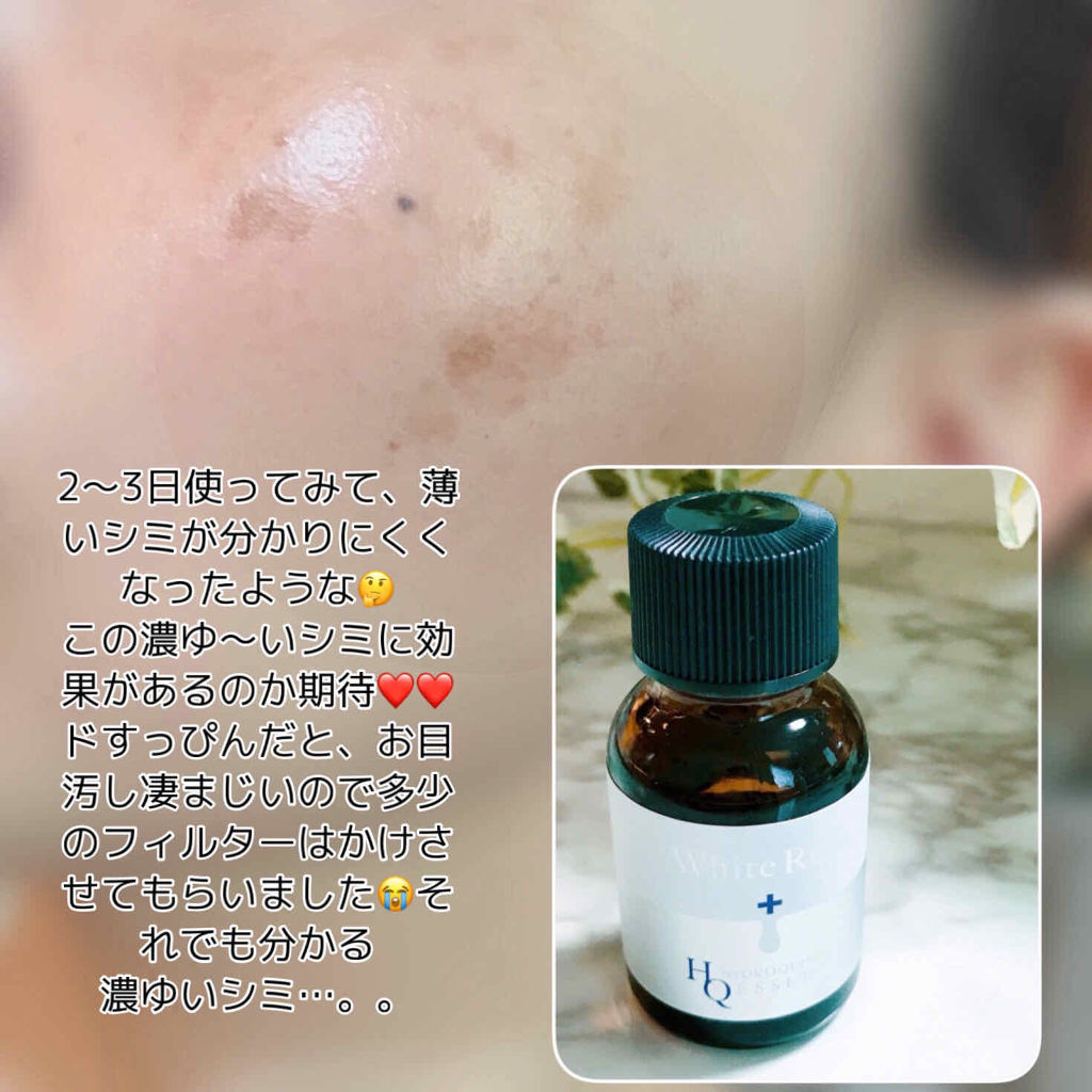 White Rush ホワイトラッシュ HQ美容液のクチコミ「⭐⭐⭐⭐⭐  

いつもいいね&温かいコメント 
ありがとうございます 💕

お気軽に、絡んで.....」（3枚目）