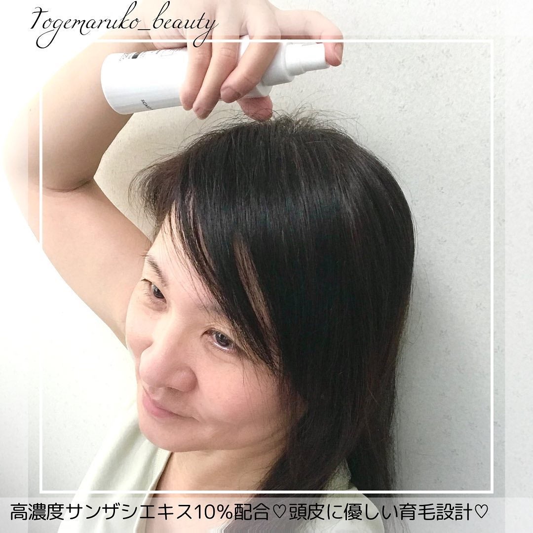 オーリム 育毛剤/OLIM/頭皮ローションを使ったクチコミ(4枚目)