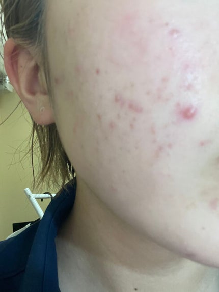 を使ったクチコミ(1枚目)