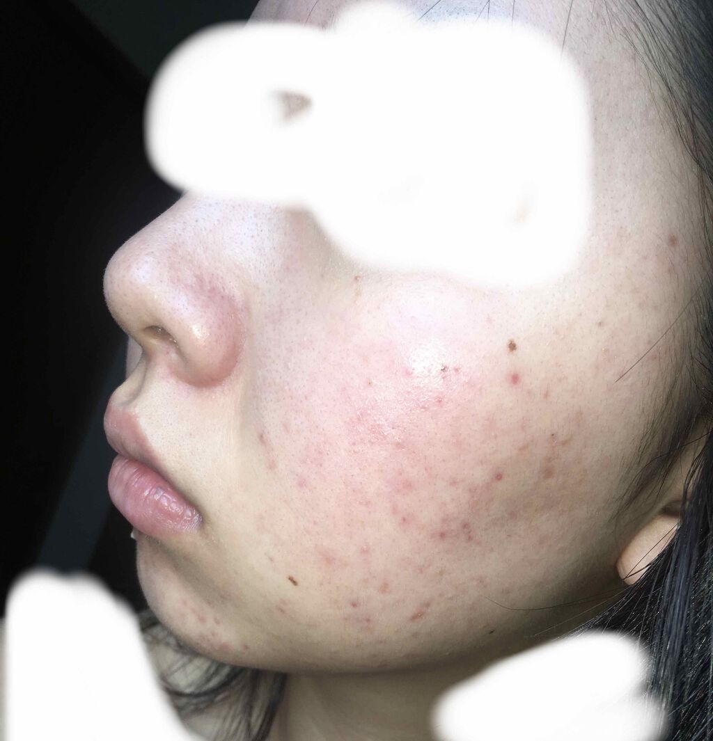 フワフワネコチャン on LIPS 「お久しぶりです!しばらく投稿してなかったのですが、最後の投稿の..」(2枚目)