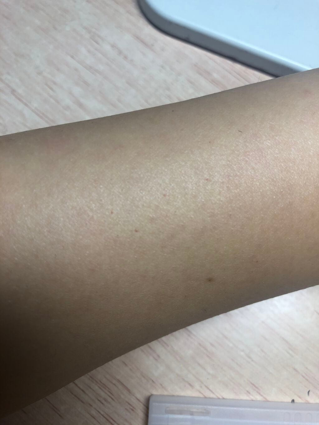 華 on LIPS 「助けてください😢😢😢😢カミソリが原因で赤いポツポツが出来てしま..」(3枚目)