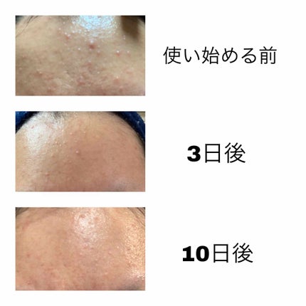 ハトムギ化粧水(ナチュリエ スキンコンディショナー R )/ナチュリエ/化粧水を使ったクチコミ(3枚目)