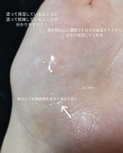 マデカバイタルカプセルセラム/センテリアン24/美容液を使ったクチコミ(5枚目)