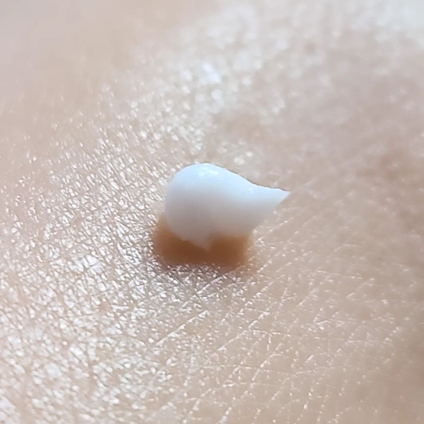 リンクルショット メディカル セラム N/リンクルショット/アイケア・アイクリームを使ったクチコミ(5枚目)