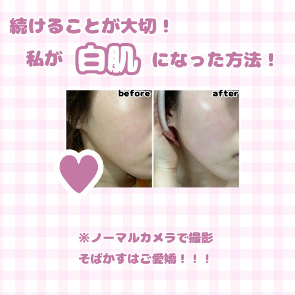 潤浸保湿 化粧水 II しっとり/キュレル/化粧水を使ったクチコミ(1枚目)