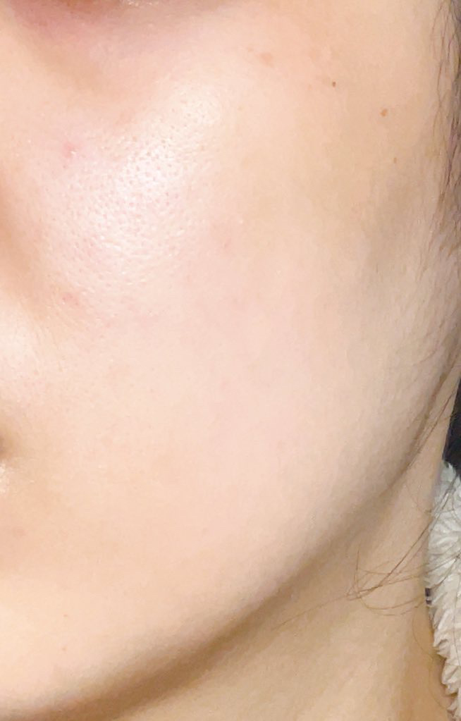 RMK Wトリートメントオイル/RMK/ブースター・導入液を使ったクチコミ（3枚目）