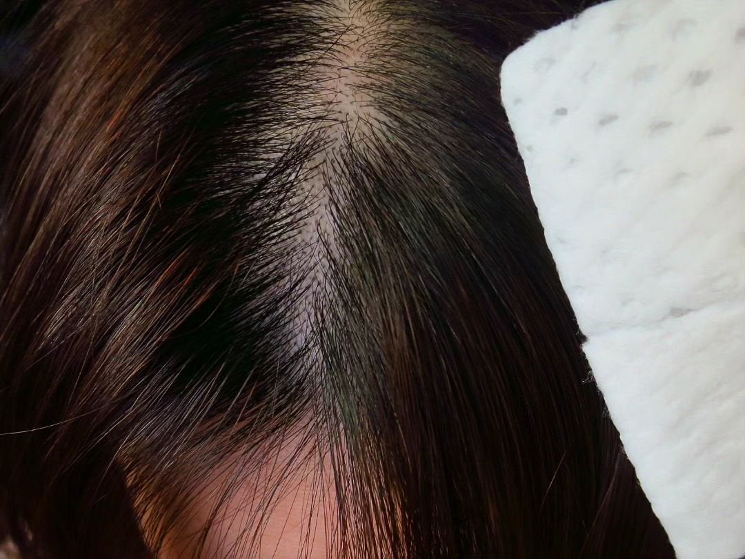 メリット ドライシャンプーシート すっきり爽快タイプ/メリット/ドライシャンプーを使ったクチコミ(3枚目)