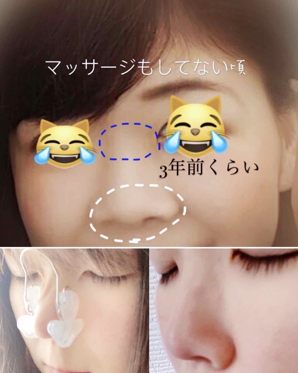 お鼻リフォーマー ハナハナ グッズマンの効果に関する口コミ 鼻筋マッサージ投稿に たくさんの と ありがとうございます By ねこたらし 乾燥肌 代後半 Lips
