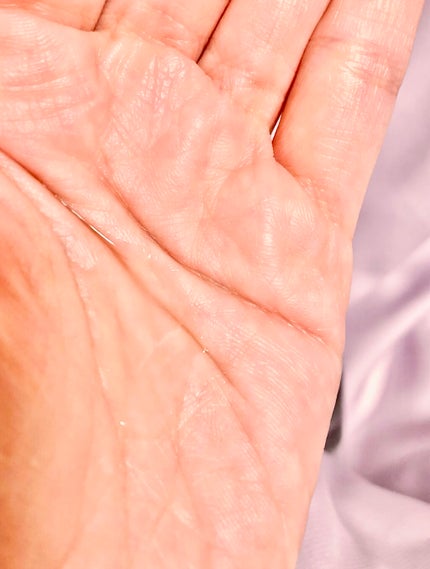 ジェニフィック アドバンスト N/LANCOME/美容液を使ったクチコミ(3枚目)