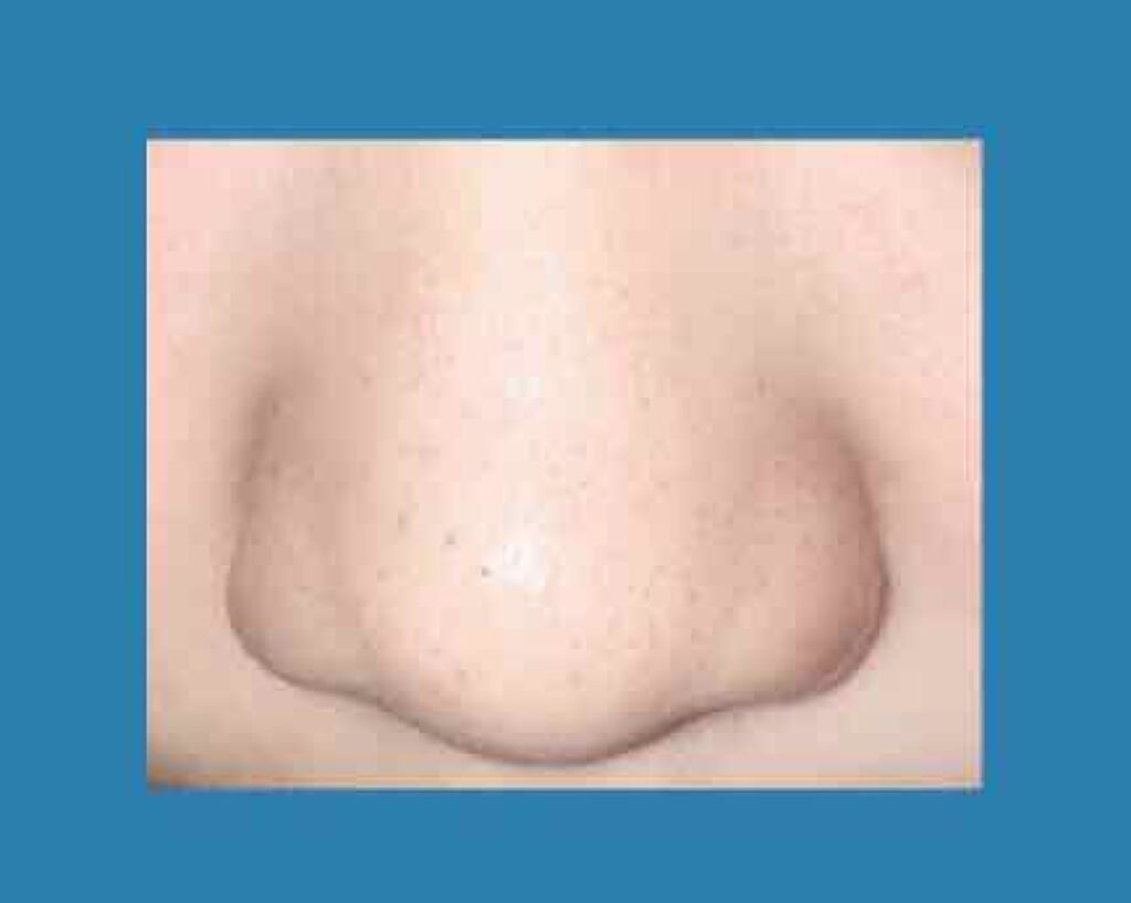 おうちdeエステ 肌をなめらかにする マッサージ洗顔ジェル/ビオレ/その他洗顔料を使ったクチコミ（2枚目）