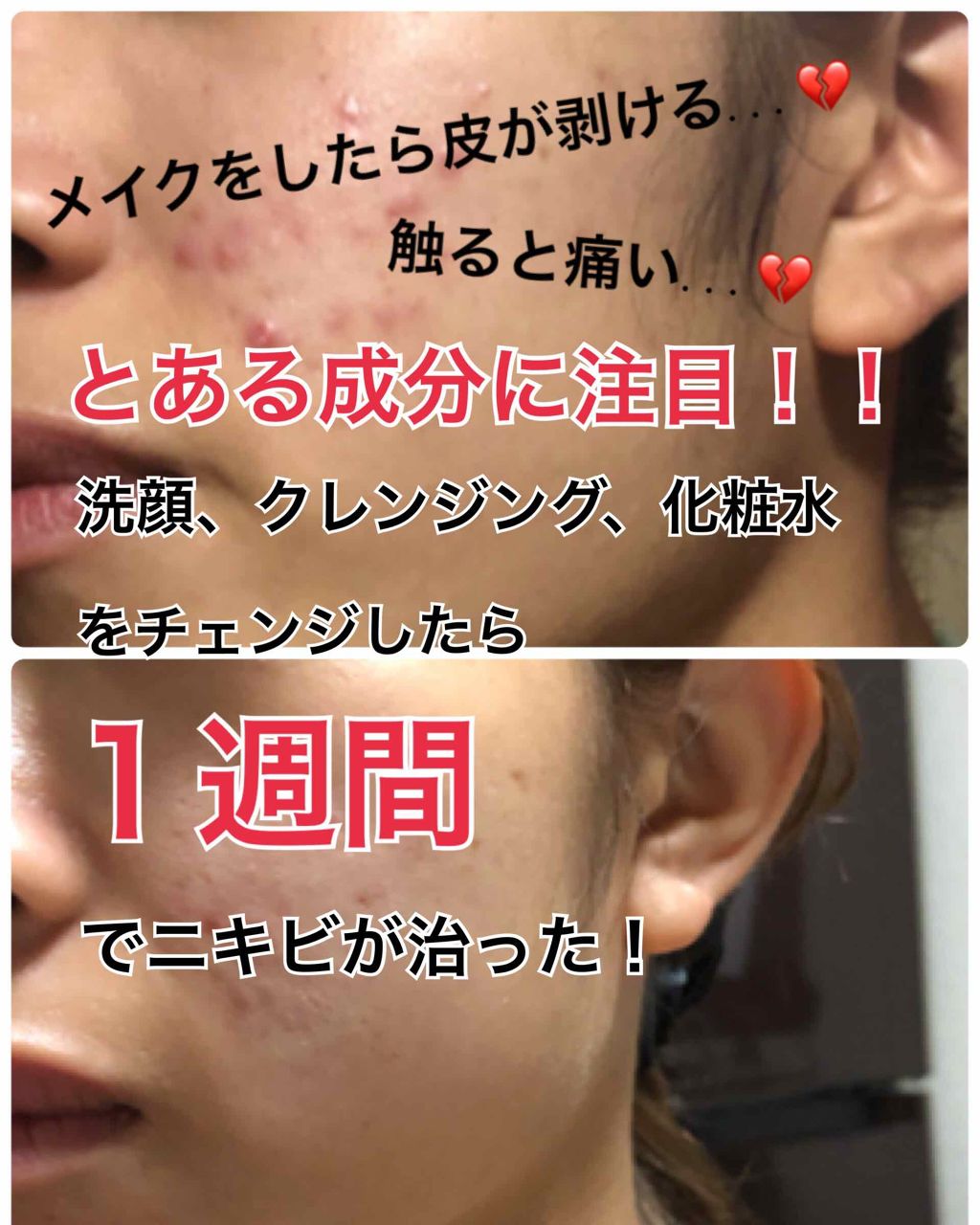 菊正宗 日本酒の化粧水 高保湿/菊正宗/化粧水を使ったクチコミ（1枚目）