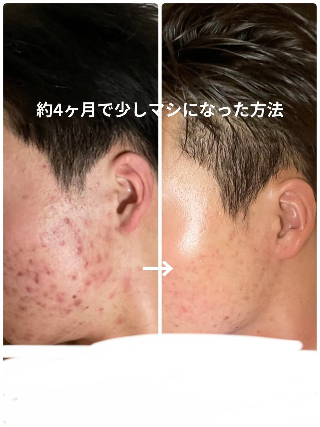 N10+Z1フェイスセラム /The Ordinary/美容液を使ったクチコミ(1枚目)