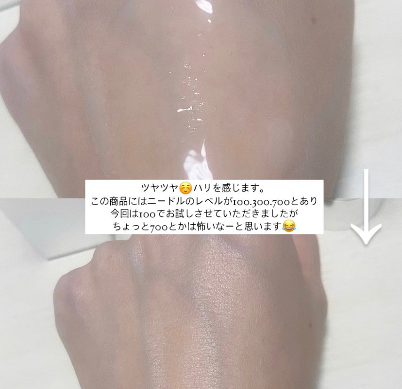 リードルショット100/VT/美容液を使ったクチコミ(3枚目)