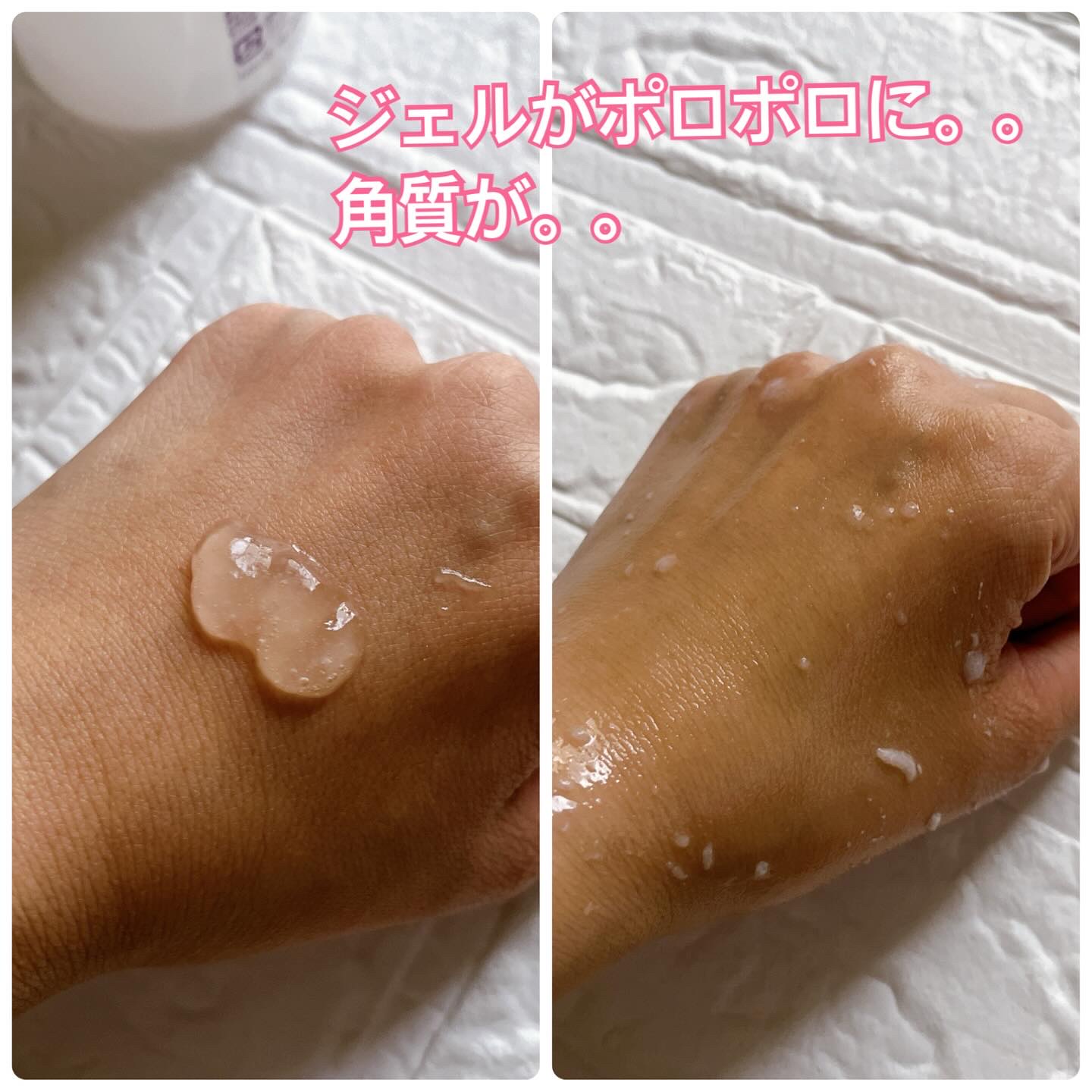 ハトムギエキスピーリングジェル/プラチナレーベル/ピーリングを使ったクチコミ（3枚目）