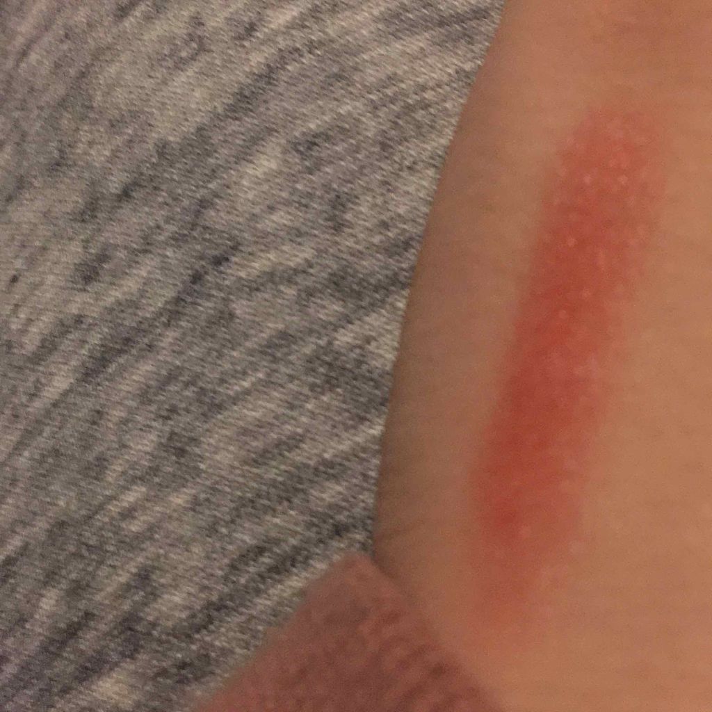 リップヴィブランス/Blistex/リップクリームを使ったクチコミ（3枚目）