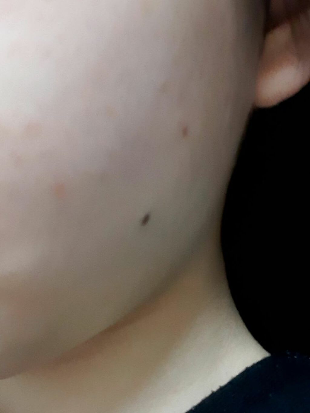 薬用化粧水/スキンライフ/化粧水を使ったクチコミ（1枚目）