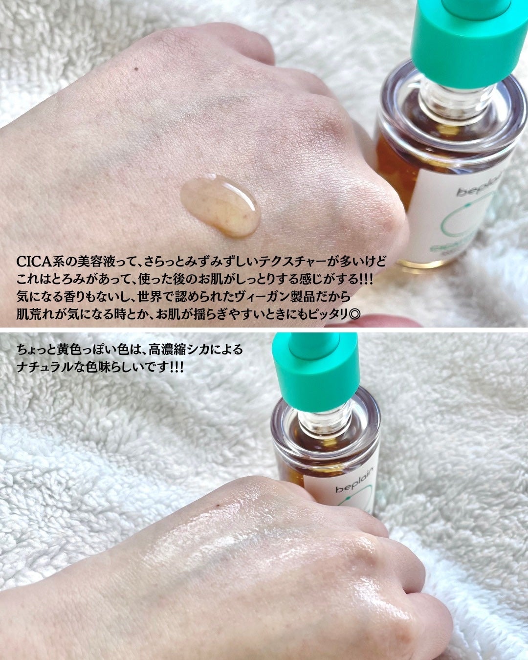 シカテロル美容液/beplain/美容液を使ったクチコミ(4枚目)